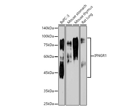 IFN-gamma R1/CD119 Antibody (2B9Q1)