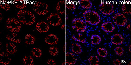 Sodium Potassium ATPase Alpha 1 Antibody (3L6F0)