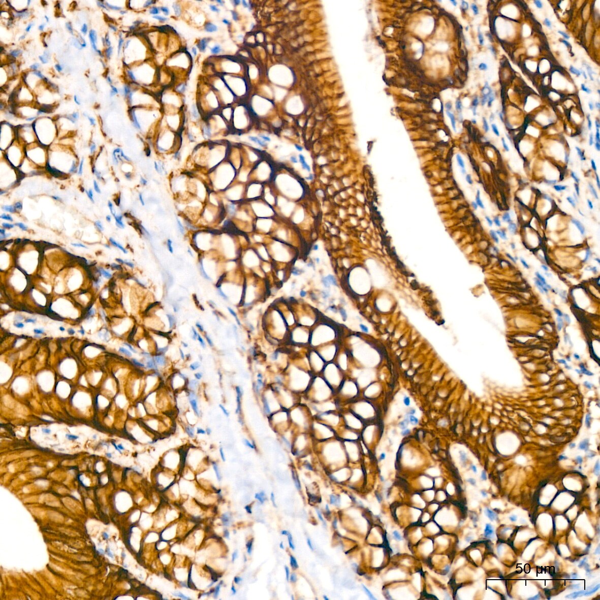 Sodium Potassium ATPase Alpha 1 Antibody (3L6F0)