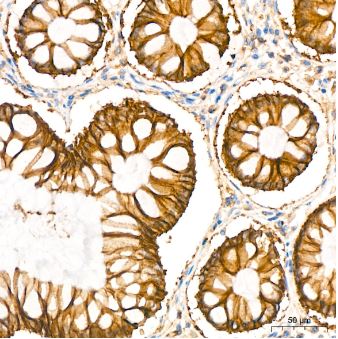 Sodium Potassium ATPase Alpha 1 Antibody (3L6F0)
