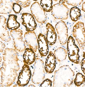 Sodium Potassium ATPase Alpha 1 Antibody (3L6F0)