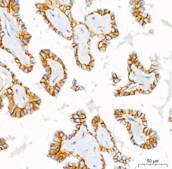 Sodium Potassium ATPase Alpha 1 Antibody (3L6F0)