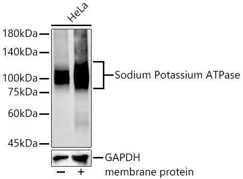 Sodium Potassium ATPase Alpha 1 Antibody (3L6F0)
