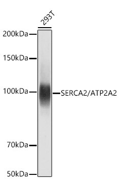 SERCA2 ATPase Antibody (10F0M9)
