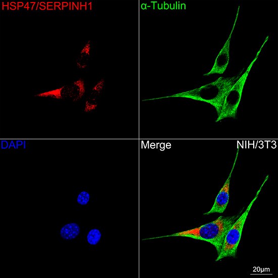 Hsp47 Antibody (3K3H1)