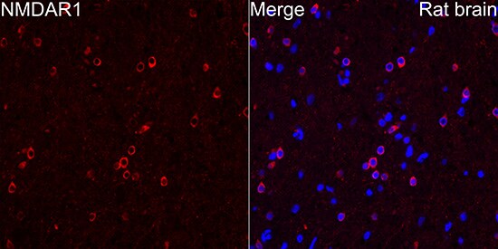 NMDAR1 Antibody (1H1T3)