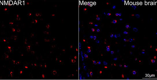 NMDAR1 Antibody (1H1T3)