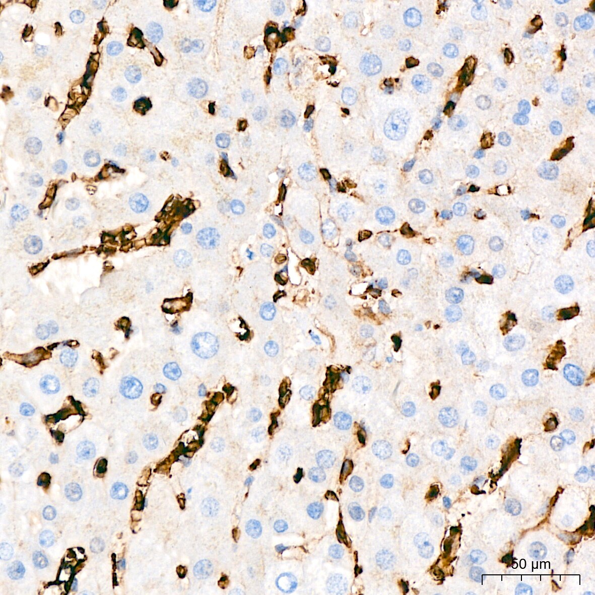 Glut1 Antibody (10O1I5)