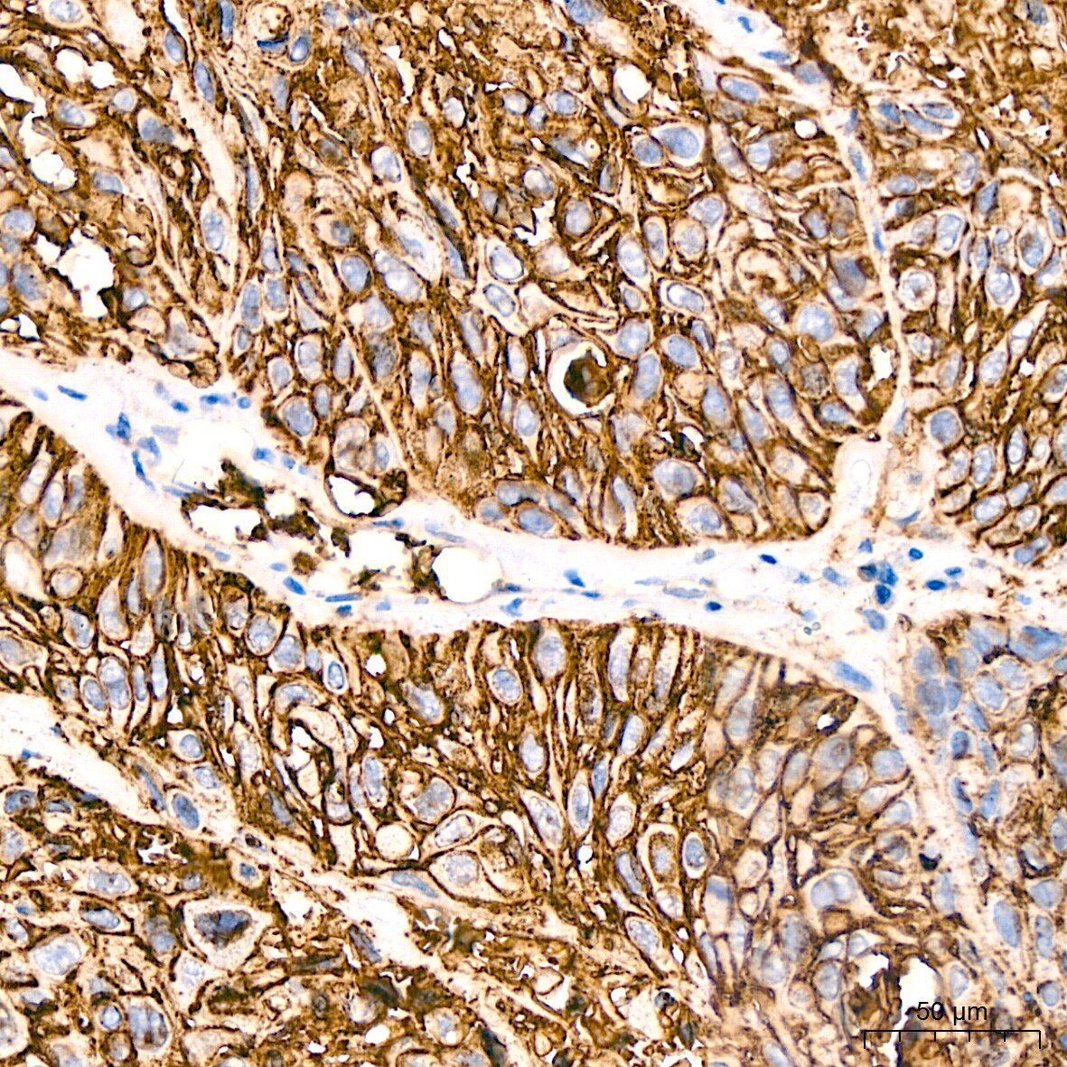 Glut1 Antibody (10O1I5)