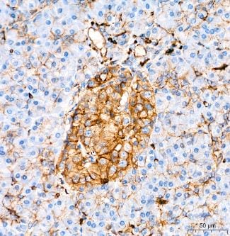Glut1 Antibody (10O1I5)