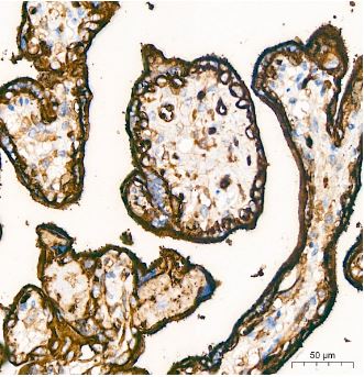 Glut1 Antibody (10O1I5)