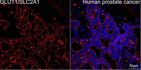 Glut1 Antibody (10O1I5)