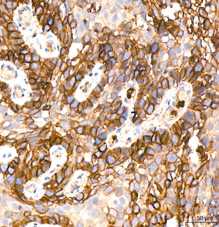 Glut1 Antibody (10O1I5)