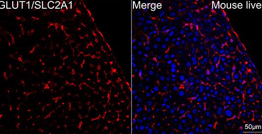 Glut1 Antibody (10O1I5)