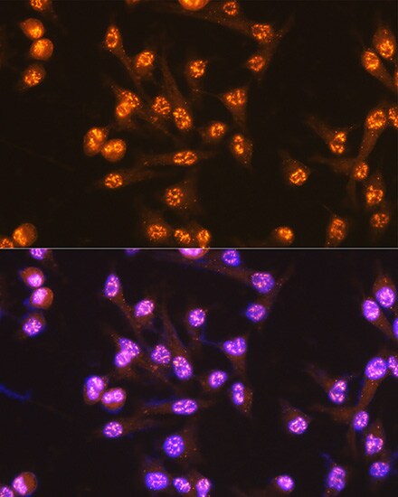 CDC25C Antibody (6R0I6)