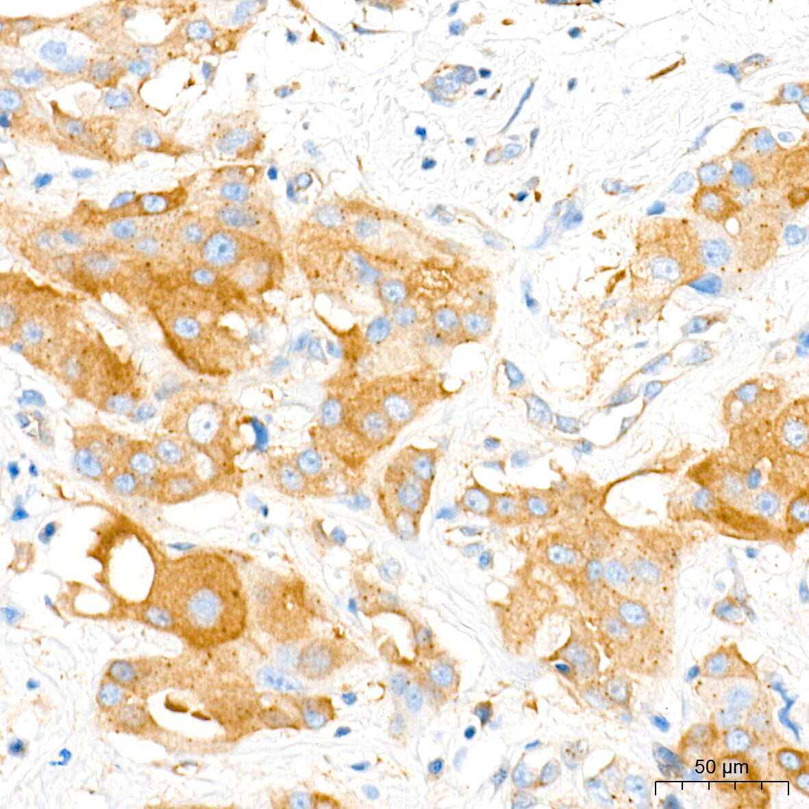 Aromatase Antibody (5C5N7)