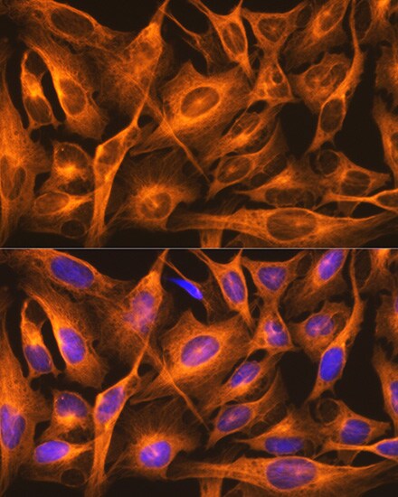 beta Tubulin Antibody (4E9G8)