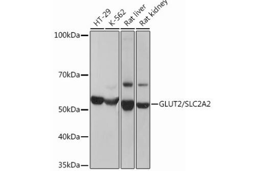 Glut2 Antibody (2V2U2)