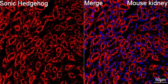 Sonic Hedgehog/Shh Antibody (8T4D3)