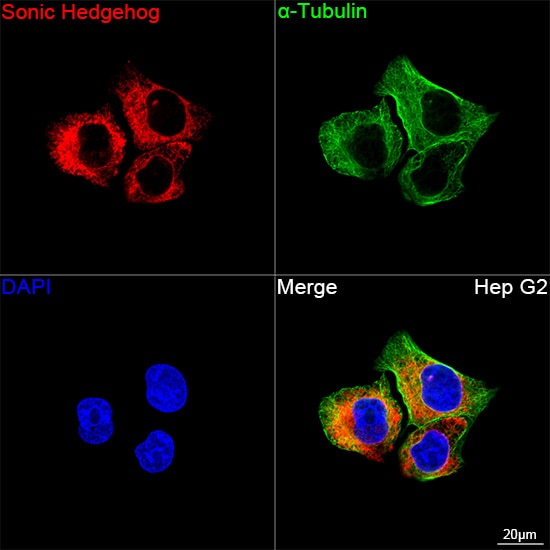 Sonic Hedgehog/Shh Antibody (8T4D3)