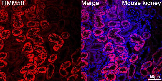 TIMM50 Antibody (0W6J4)