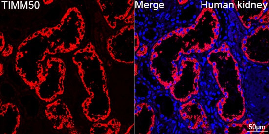TIMM50 Antibody (0W6J4)