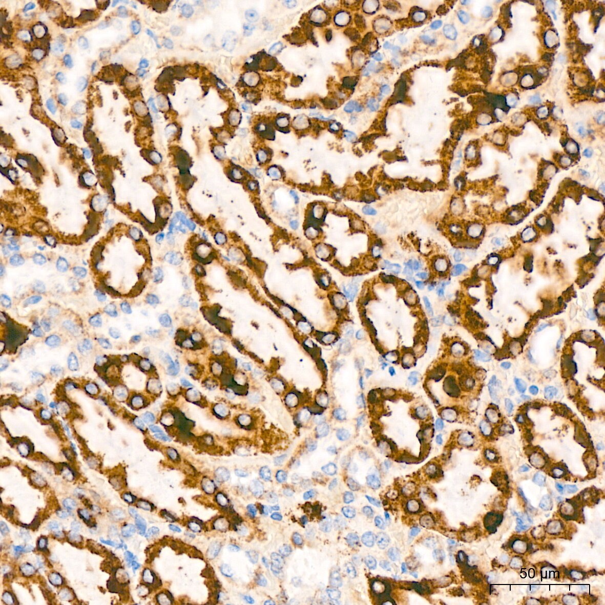 TIMM50 Antibody (0W6J4)