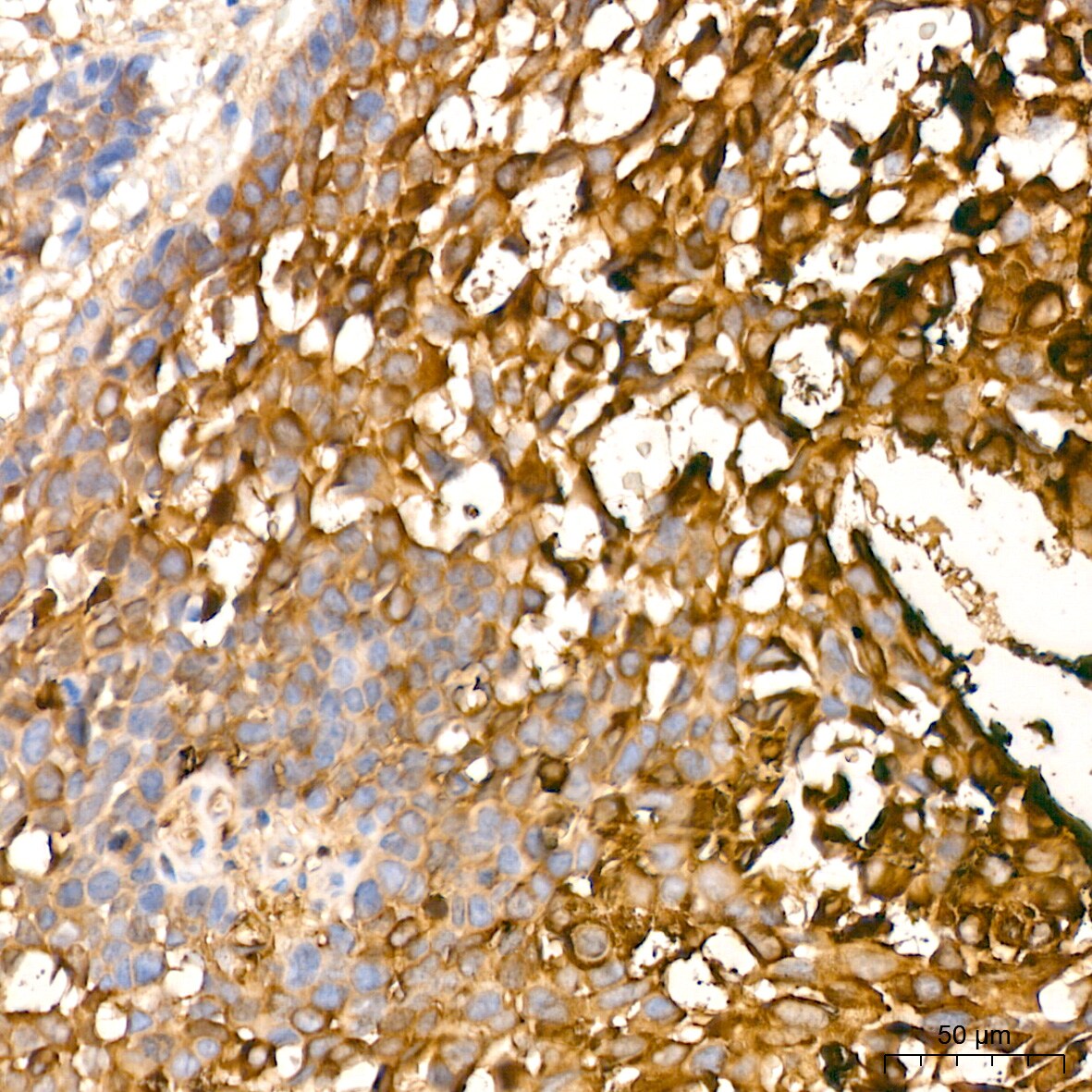 Involucrin Antibody (8H7B3)