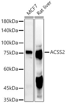 Acetyl CoA synthetase Antibody - BSA Free