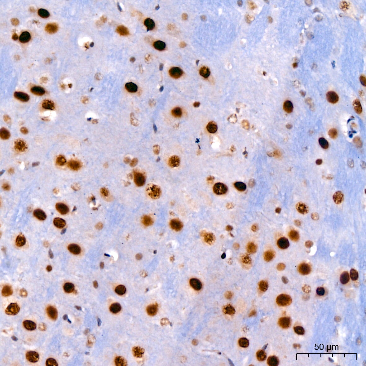 KLF4 Antibody (7B7U1)