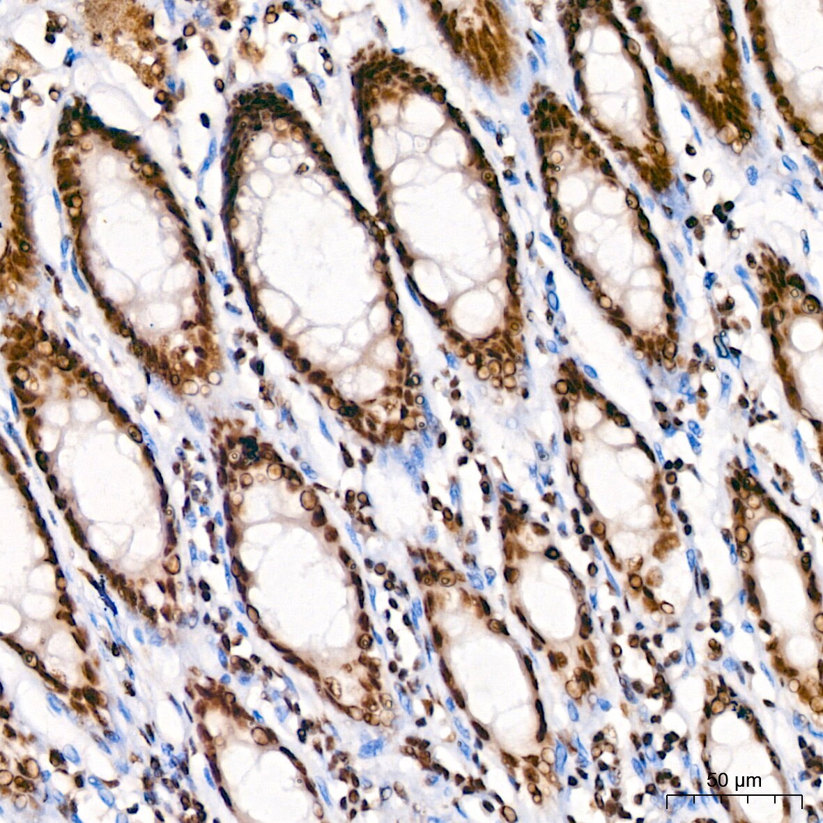 KLF4 Antibody (7B7U1)