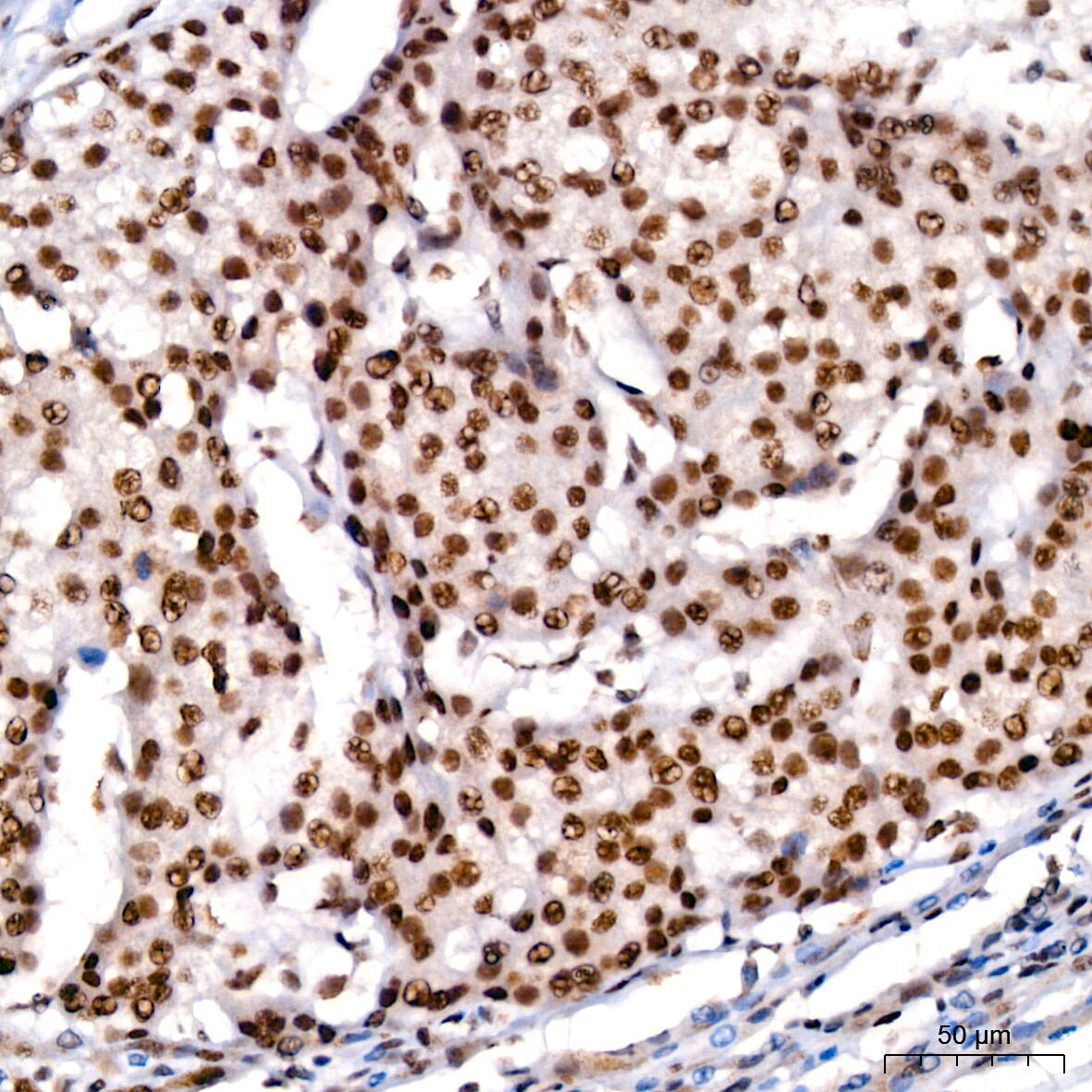 KLF4 Antibody (7B7U1)
