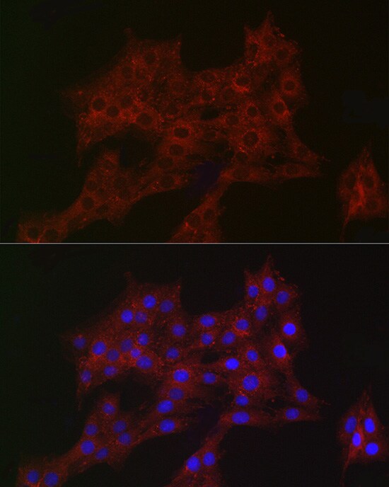 ARPC2 Antibody (4F2G6)