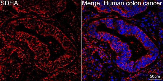 SDHA Antibody (0Y8X5)