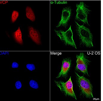 p97/VCP Antibody (3P8T3)
