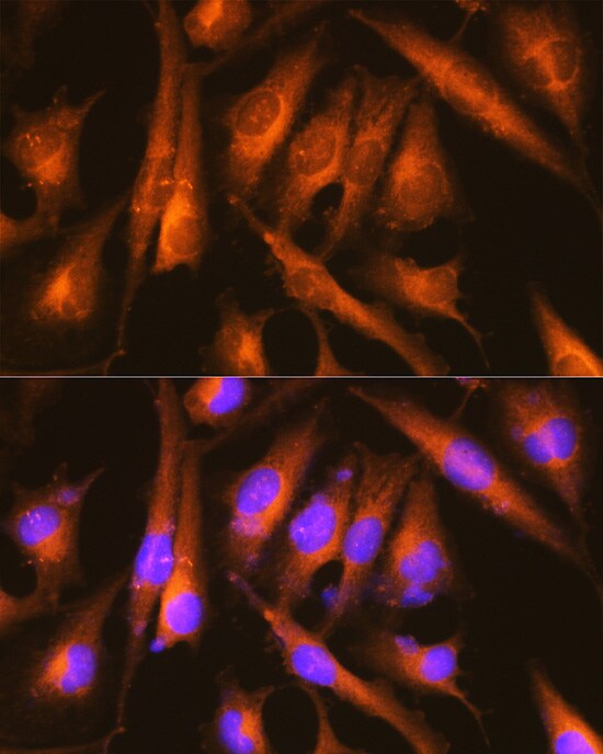 Huntingtin Antibody - Azide and BSA Free