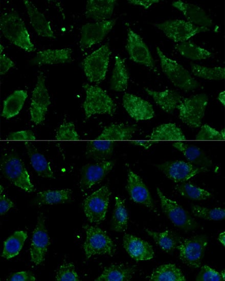 NDUFB1 Antibody - Azide and BSA Free