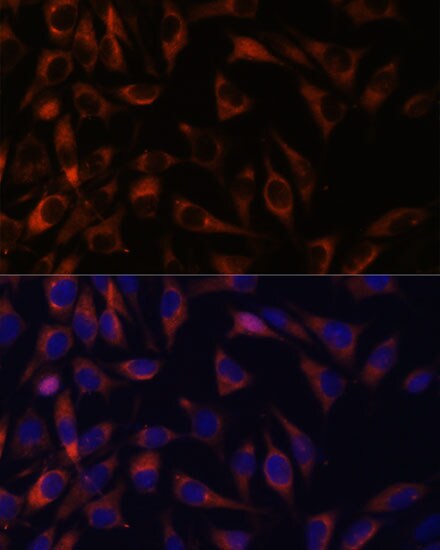 WFDC1 Antibody - Azide and BSA Free