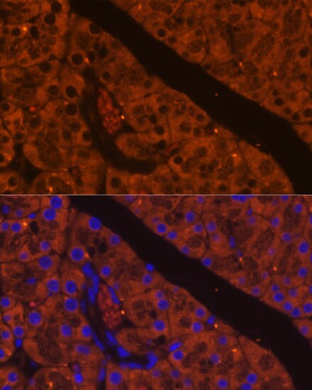 ELA2A Antibody - Azide and BSA Free