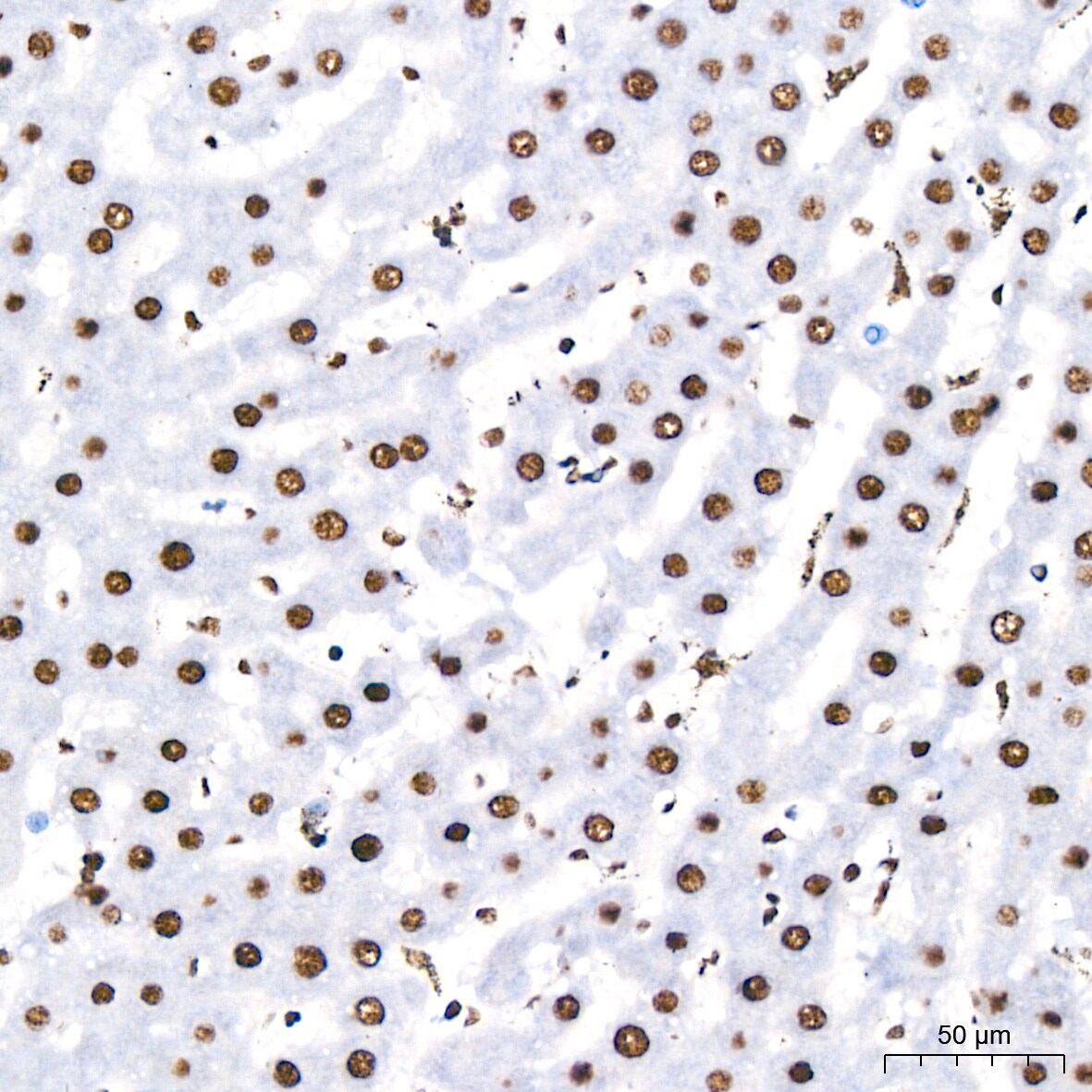 PABPN1 Antibody (7V4X8)