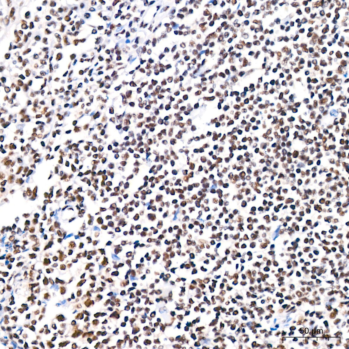 PABPN1 Antibody (7V4X8)