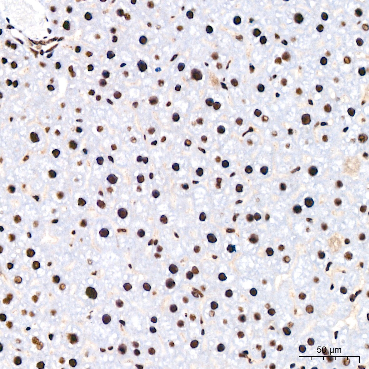 PABPN1 Antibody (7V4X8)