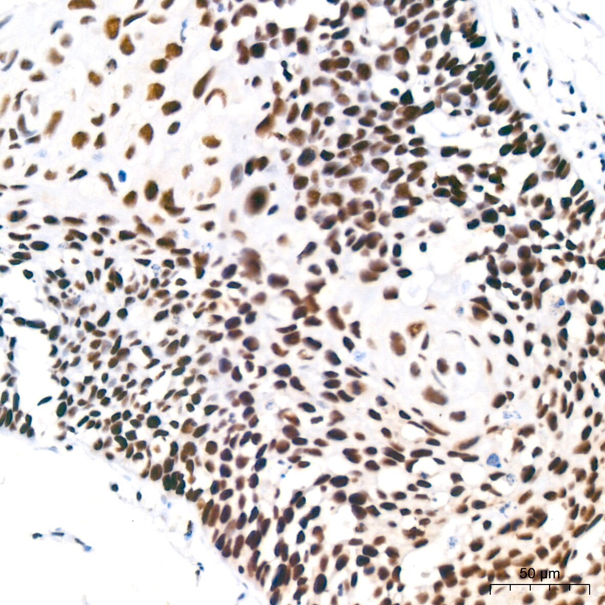 PABPN1 Antibody (7V4X8)