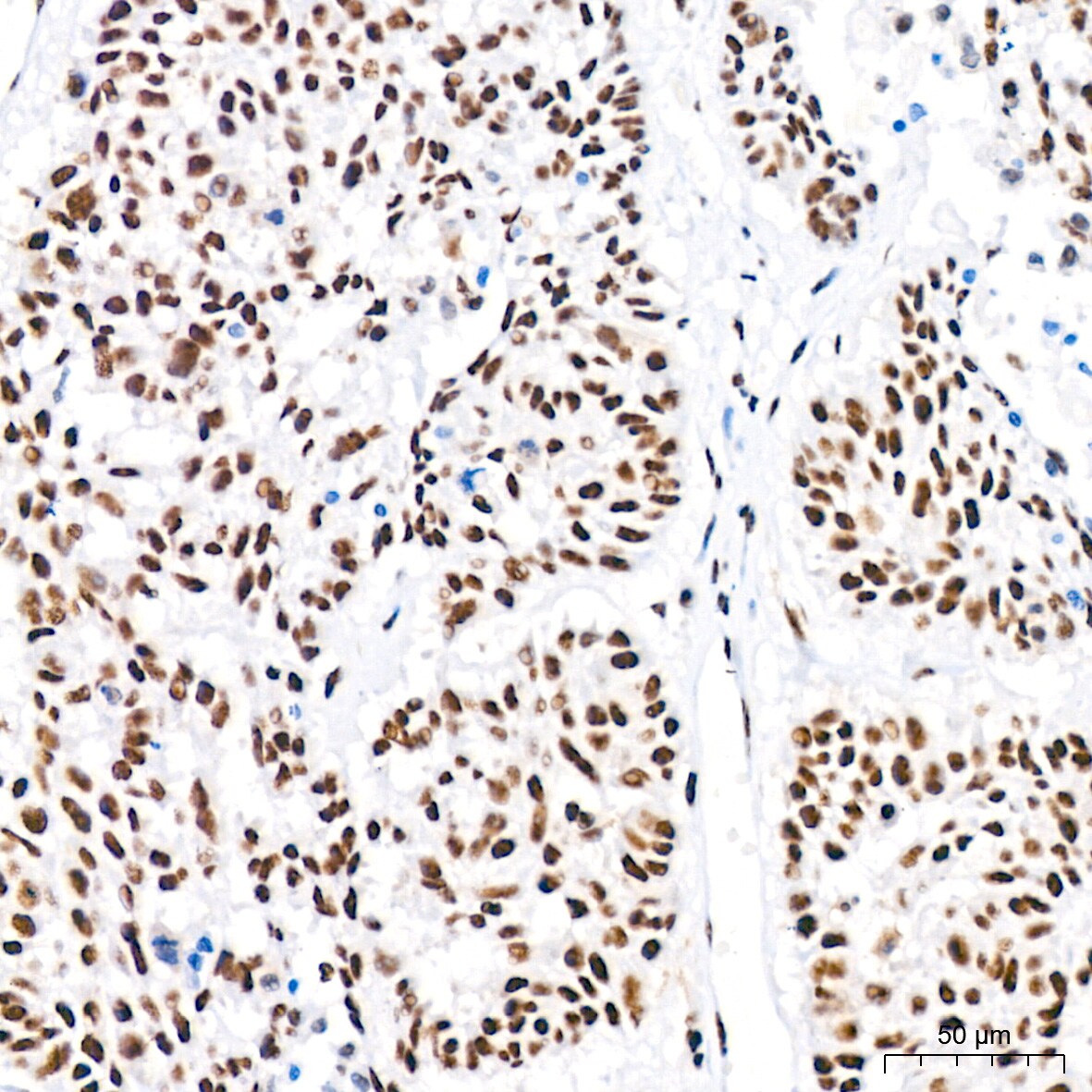 PABPN1 Antibody (7V4X8)