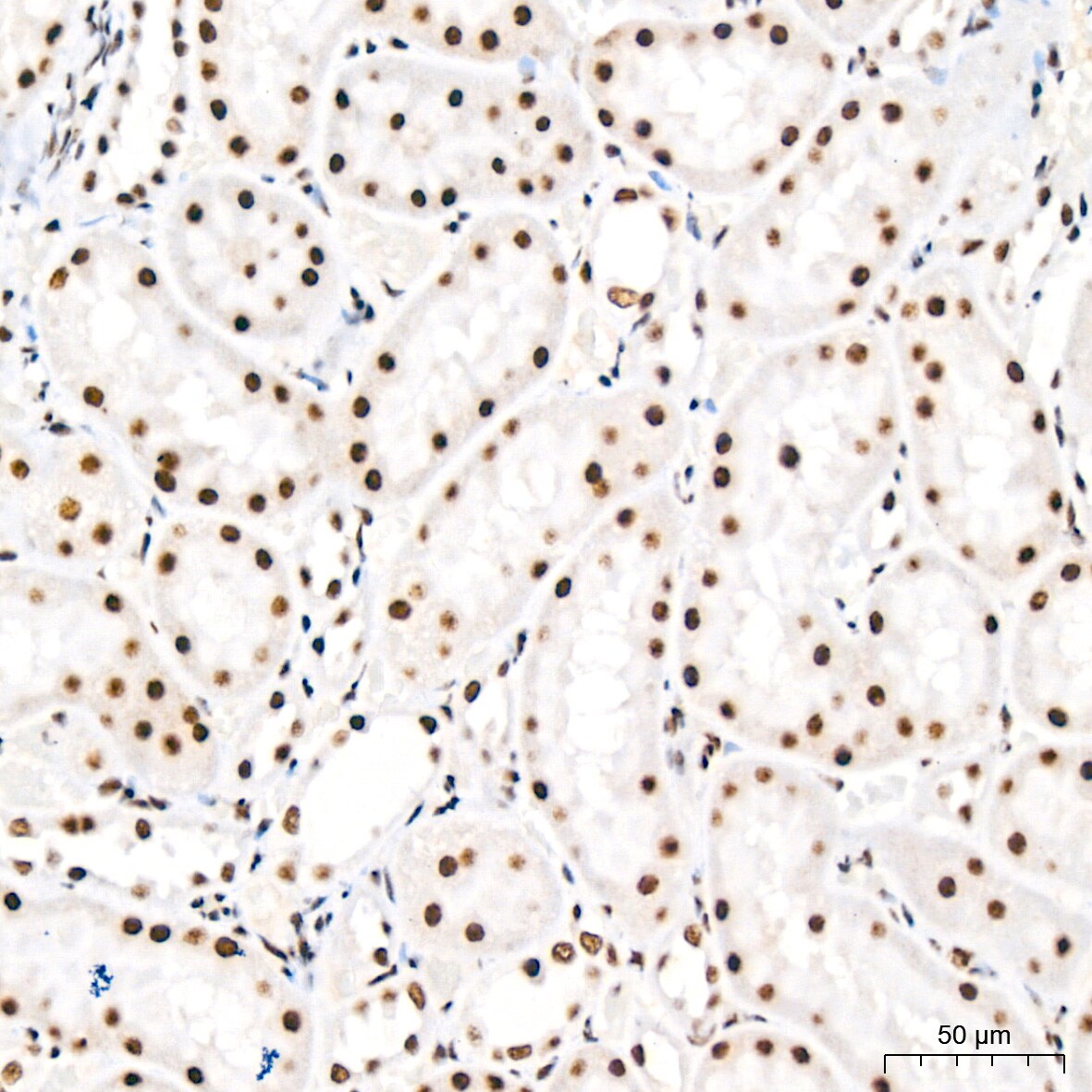 PABPN1 Antibody (7V4X8)