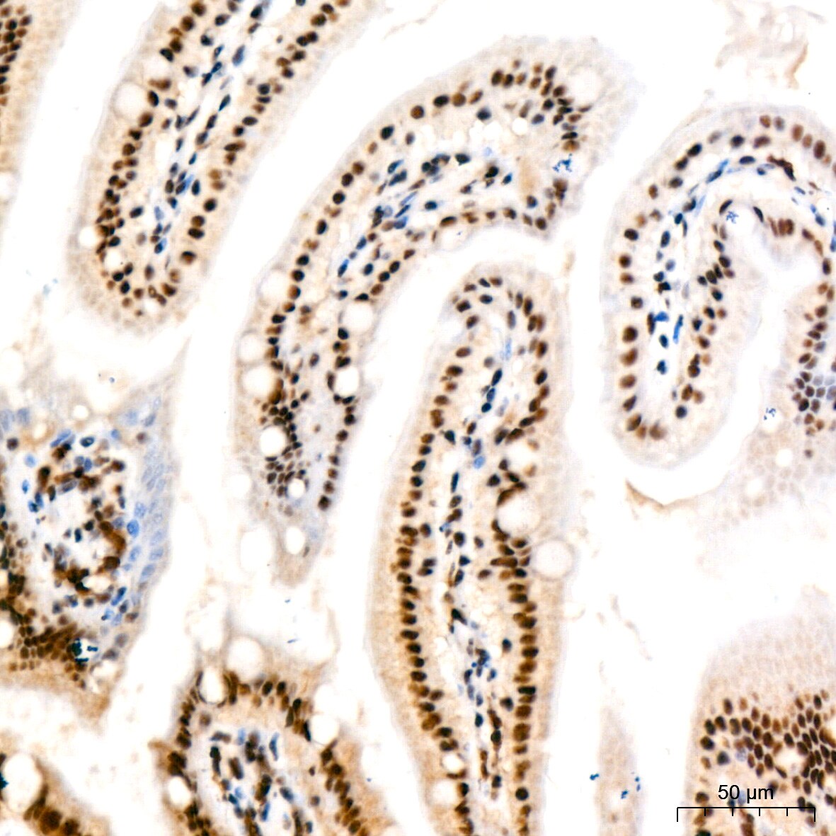 PABPN1 Antibody (7V4X8)