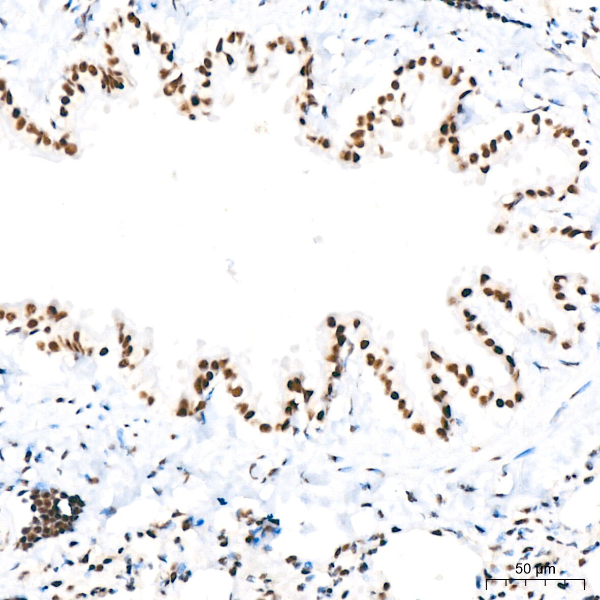 PABPN1 Antibody (7V4X8)