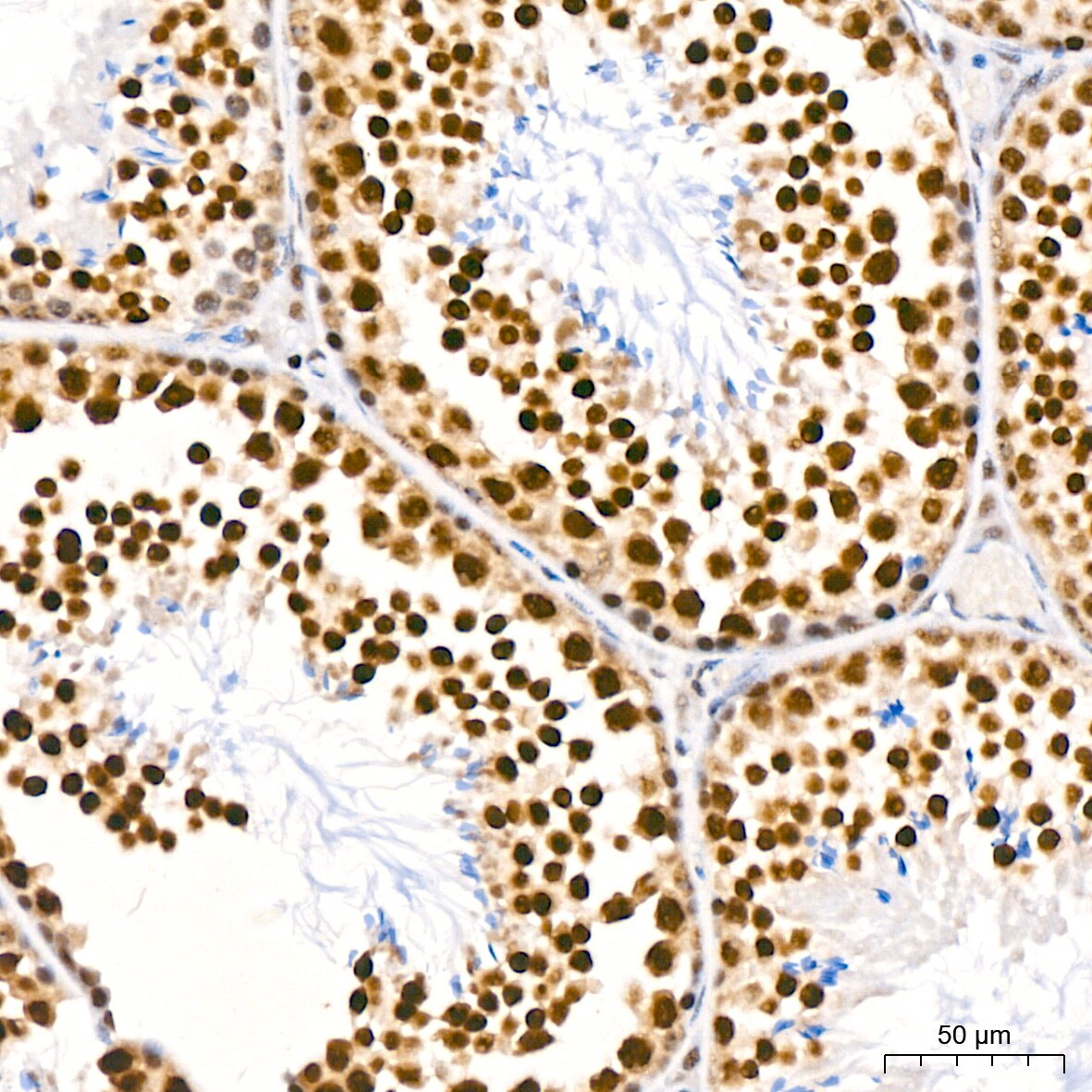 PABPN1 Antibody (7V4X8)