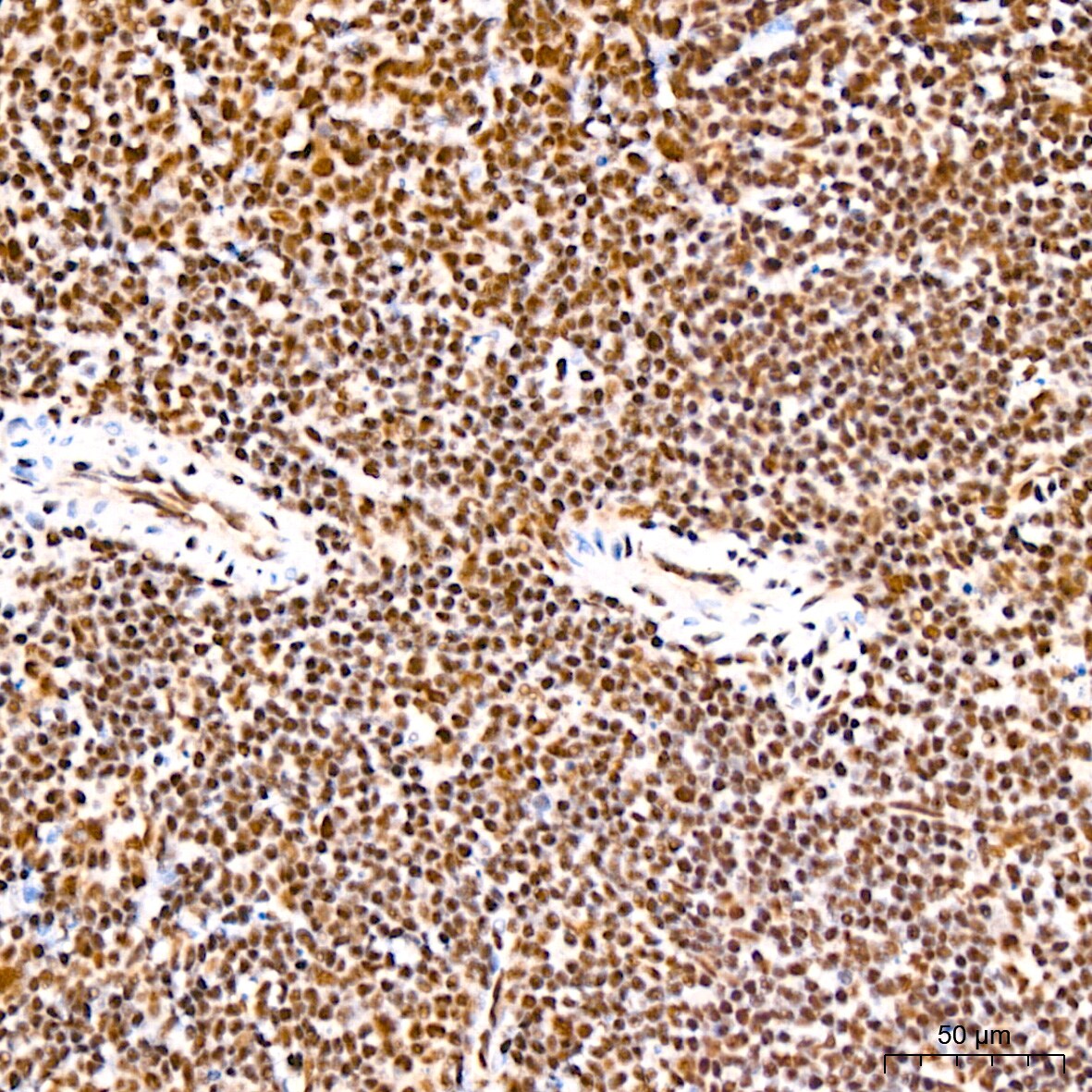 PABPN1 Antibody (7V4X8)