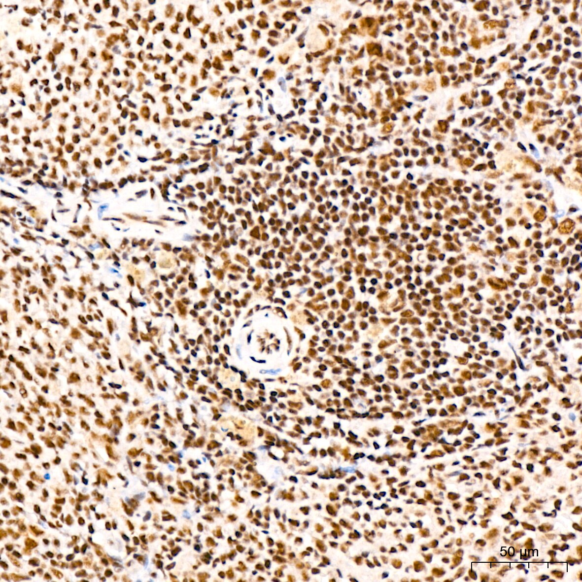 PABPN1 Antibody (7V4X8)